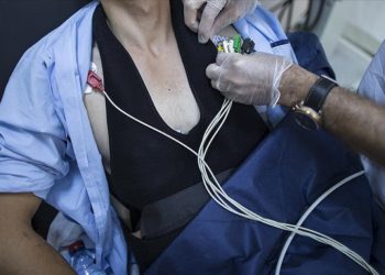 Türkiye’de her yıl yaklaşık 300 bin kişi kalp krizi geçiriyor