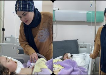 Yüzüne kızgın yağ dökülen 3 yaşındaki Leyla, deri nakliyle sağlığına kavuştu