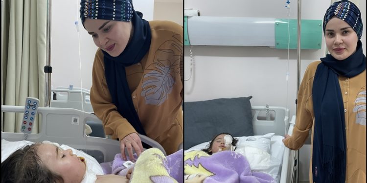 Yüzüne kızgın yağ dökülen 3 yaşındaki Leyla, deri nakliyle sağlığına kavuştu