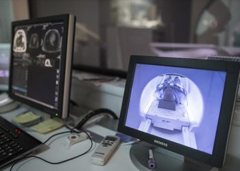 İnme rahatsızlıklarında beyne pıhtı atılması "şapka yöntemi"yle ameliyatsız önlenebiliyor