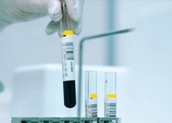 Türkiye’de nüfusun yüzde 2,1’i Akdeniz anemisi hastalığını taşıyor