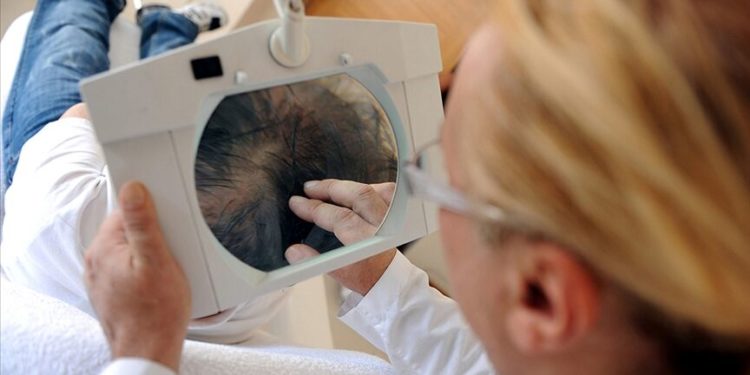 Saç ekimi merkezlerine yeni standart getirildi