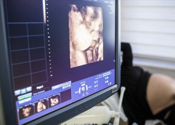 ABD'de anne karnındaki bebeğe beyin ameliyatı yapıldı