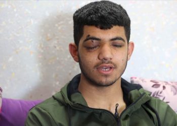 İsrail’in attığı ses bombası nedeniyle görme yetisini kaybeden Filistinli çocuk “hayallerine” tutunuyor
