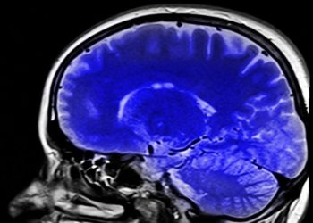 Kronik ağrıların beyindeki kaynağını inceleyen araştırma, hastalara umut olabilir