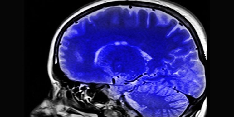 Kronik ağrıların beyindeki kaynağını inceleyen araştırma, hastalara umut olabilir