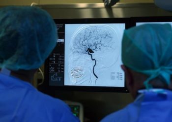 Araştırmacılar Huntington hastalığının beyindeki oluşum sürecine yönelik bulgular elde etti