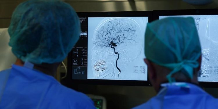 Araştırmacılar Huntington hastalığının beyindeki oluşum sürecine yönelik bulgular elde etti