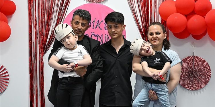 Ameliyatla ayrılan siyam ikizleri okula hazırlanıyor