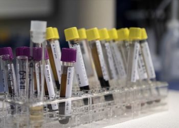 Dünyada 320 milyon kişinin hepatit B ve C hastası olduğu tahmin ediliyor