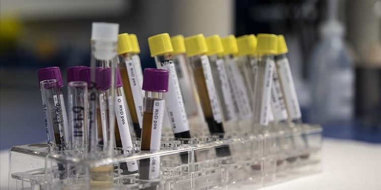 Dünyada 320 milyon kişinin hepatit B ve C hastası olduğu tahmin ediliyor