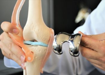 Diz kireçlenmelerine karşı ameliyatsız “hidrojel” uygulaması