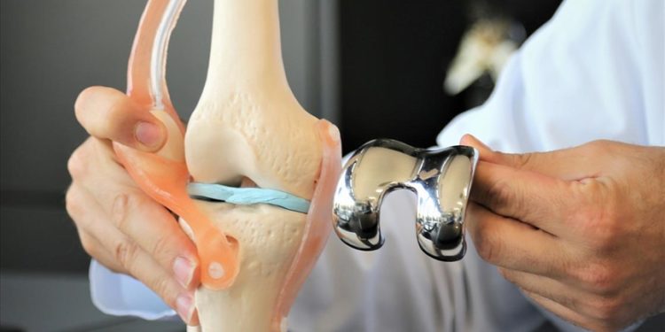 Diz kireçlenmelerine karşı ameliyatsız “hidrojel” uygulaması