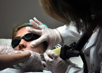 Lazerle “ben” aldırmak kanser tehlikesine kapı aralıyor