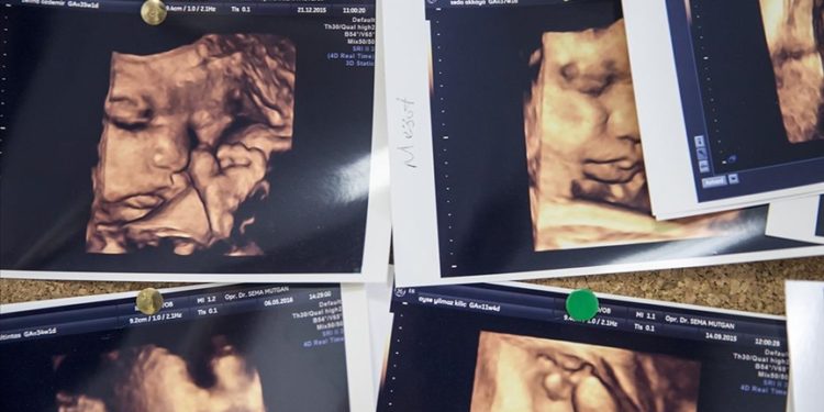 Çoğul gebelik oranları Kovid-19 sonrası dünya genelinde artışa geçti