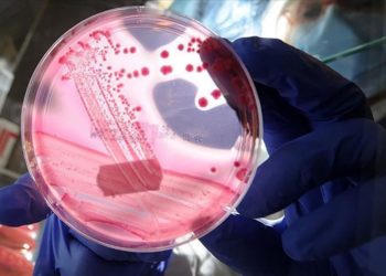 Japonya'da araştırmacılar, yumurtalık kanserini erken teşhis edebilecek proteinler keşfetti