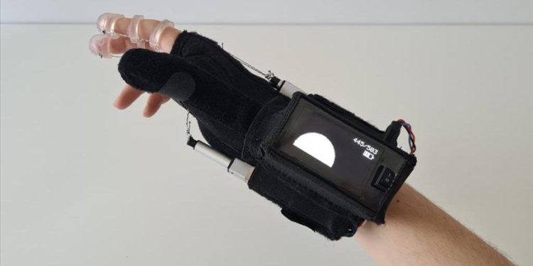 Uludağ Üniversitesinde kısmi felçli hastalar için “mobil el dış iskeleti” geliştirildi