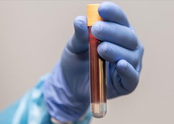 50-70 yaş arası erkeklere, prostat kanserine karşı yılda bir kez kan testi uyarısı