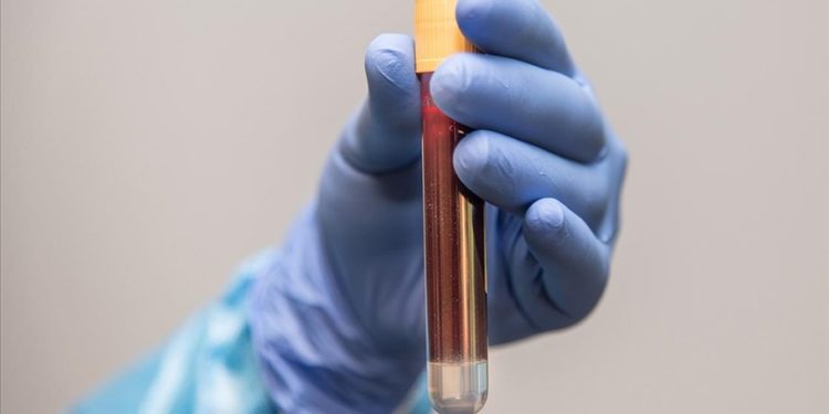 50-70 yaş arası erkeklere, prostat kanserine karşı yılda bir kez kan testi uyarısı