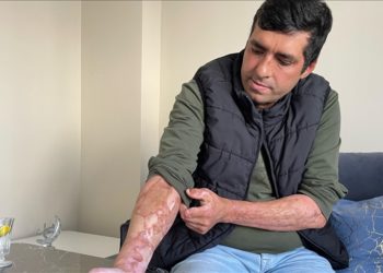 Bartın’da maden ocağındaki patlamadan yaralı kurtulan işçiler, arkadaşlarını unutamıyor