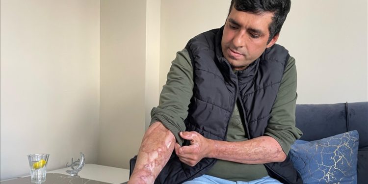 Bartın’da maden ocağındaki patlamadan yaralı kurtulan işçiler, arkadaşlarını unutamıyor