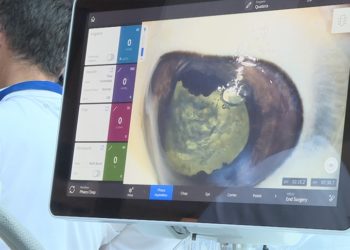 Diyabetin kontrol altında tutulması göz sağlığı için de önemli