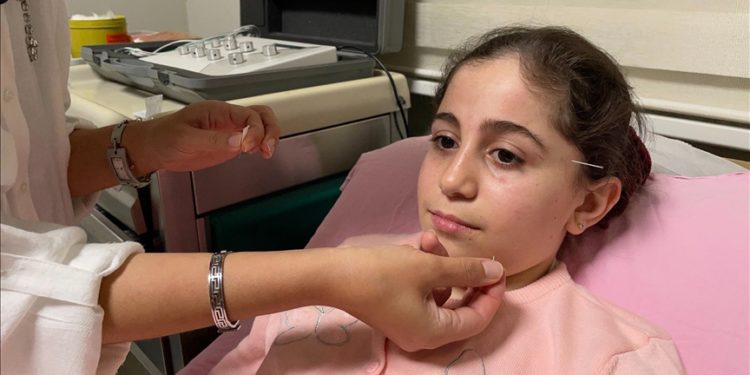Yüz felci geçiren 10 yaşındaki çocuk akupunktur ile sağlığına kavuştu