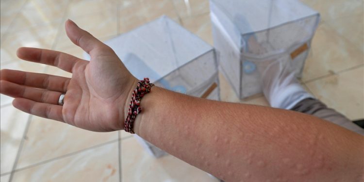 Dünya genelinde 4 milyar kişi dang humması virüsüne yakalanma riskiyle karşı karşıya