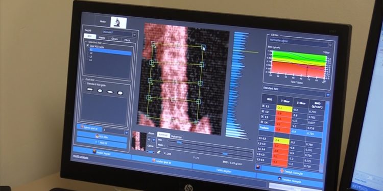Kadınlarda kemik kırıklarının nedeni osteoporoz polikliniğinde araştırılıyor