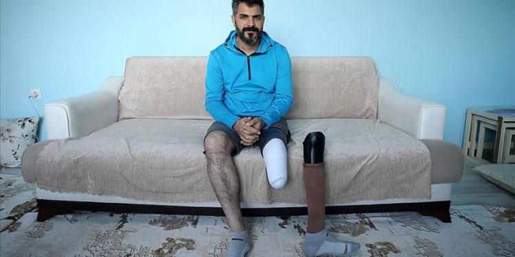 Ayağı 5 yaşındayken kesildi, sporla hayata tutundu