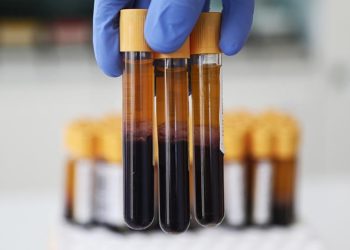 Kan testiyle hızlı ve yavaş yaşlanan organlar tespit edilebilir