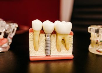Dental turizmin 2023 beklentisi 300 milyon dolar