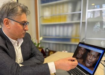 Gabonlu hastanın çenesindeki devasa tümör Türkiye’de 10 saatte temizlendi