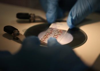 Arı zehrinin tümör hücrelerini yok edici etkisi laboratuvar ortamında kanıtlandı