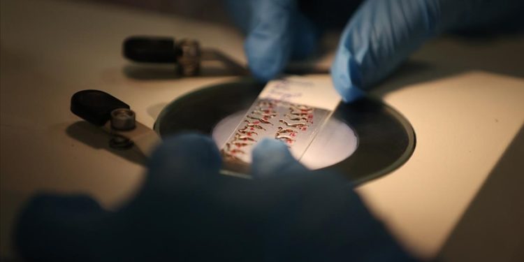 Arı zehrinin tümör hücrelerini yok edici etkisi laboratuvar ortamında kanıtlandı