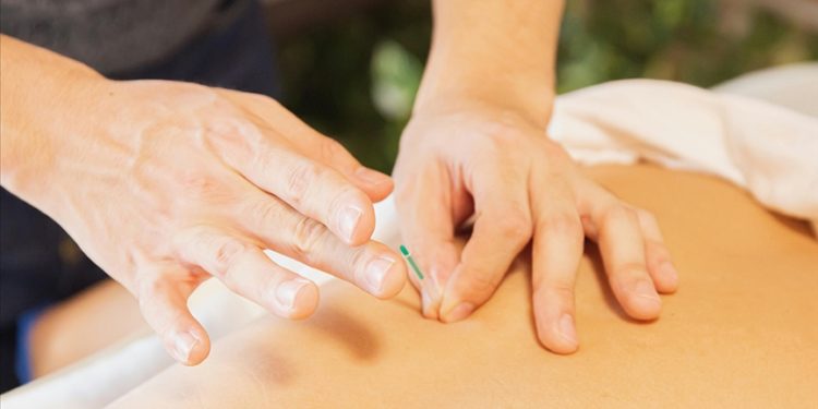 Akupunkturun inme sonrası konuşma güçlüğü çekenlerin tedavisine katkıda bulunduğu belirlendi