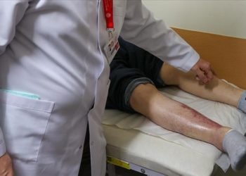 Kapanmayan yaralarından kök hücre tedavisiyle kurtuldu