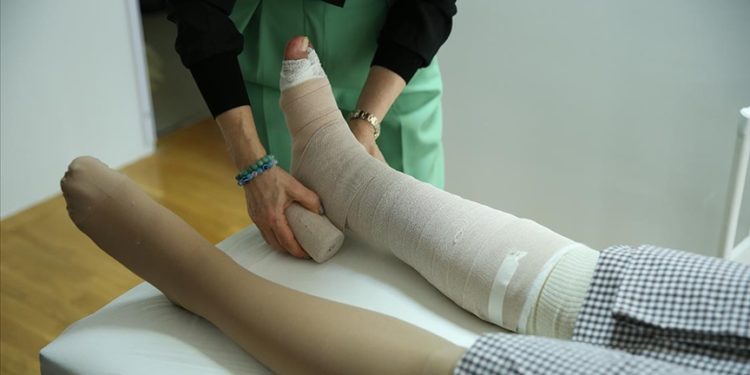 Fil hastalığında sülük tedavisi çare değil dert olabilir