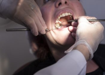 AB, amalgam dolguyu yasaklıyor