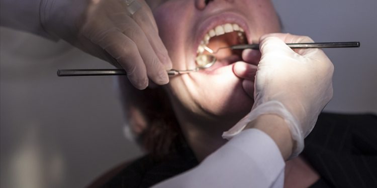 AB, amalgam dolguyu yasaklıyor