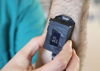 Anestezi profesörü KOSGEB desteğiyle “vücut ısısı takip ve ikaz cihazı” geliştirdi