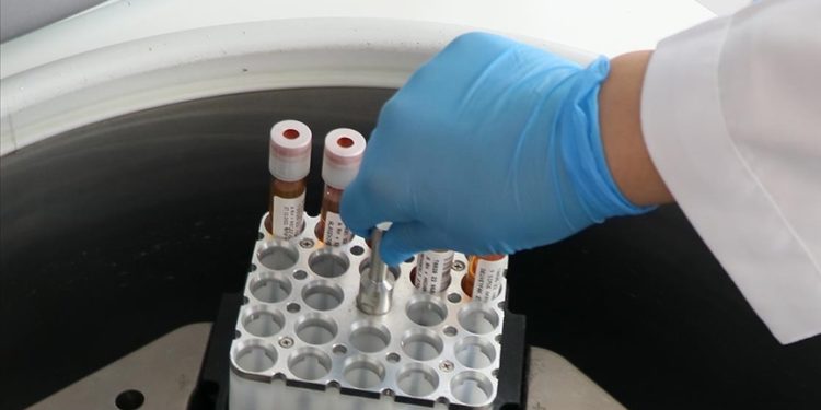 Türkiye'de 2023'te 5 binden fazla kök hücre nakli yapıldı