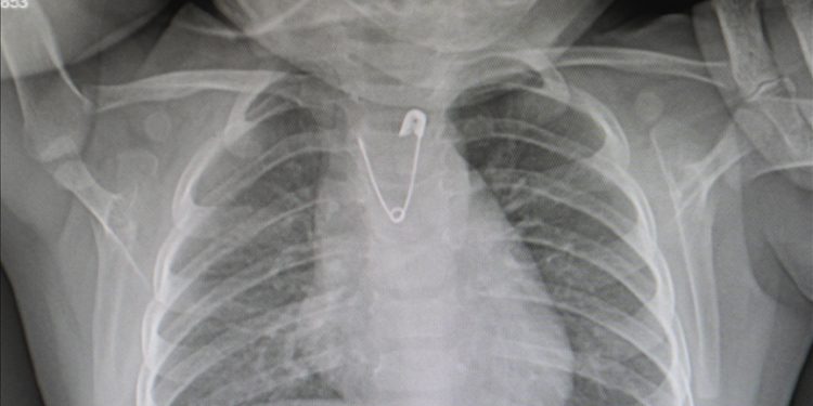 “Yutma riskine karşı bebeklere nazar boncuğu, kolye takılmamalı” uyarısı