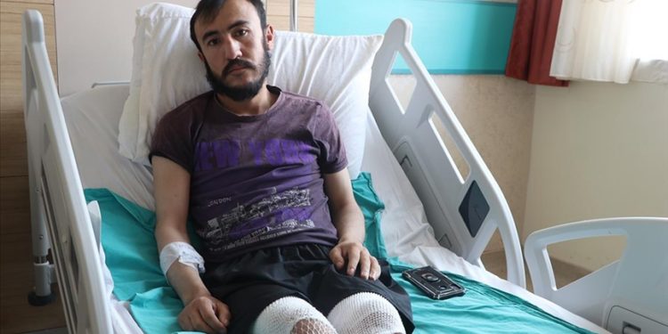 Yıldırım isabet eden çobanın bacakları cilt nakli ve cerrahi müdahaleyle kurtarıldı