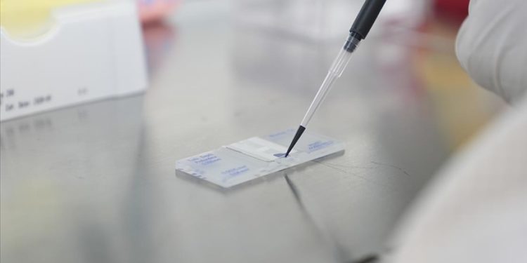 ODTÜ’nün çip merkezi sağlıkta 9 kritik alanda yerli çip üretiyor