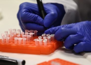 Sağlık Bakanlığı: M çiçeği hastalığı vakasına Türkiye'de rastlanmadı