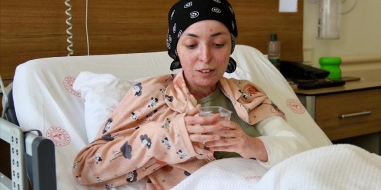 "Kelebek hastası" kolundaki tümörden Eskişehir Şehir Hastanesindeki operasyonla kurtuldu