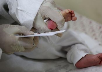 Bebeklerde “topuk kanı taraması” kalıtsal hastalıkların erken teşhisini sağlıyor