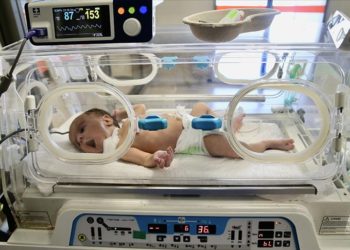 Yemek borusu oluşmadan doğan 2 aylık bebek, midesine takılan tüple besleniyor