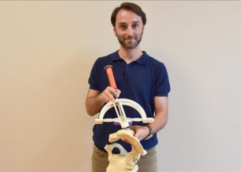 Ordu’da akademisyenlerin geliştirdiği aparat, kalça protezlerinde çıkık riskini azaltacak